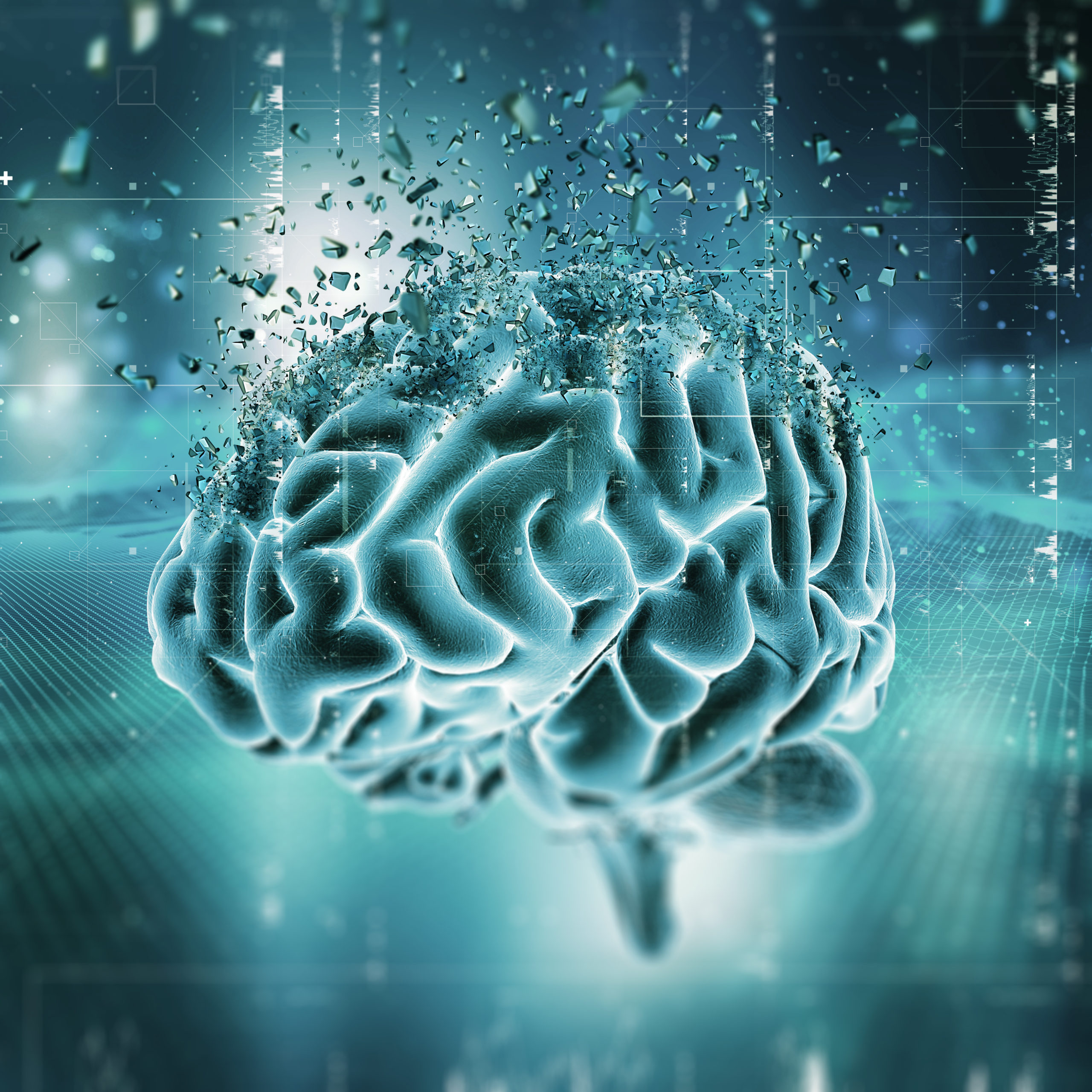 3D medical image showing a brain shattering